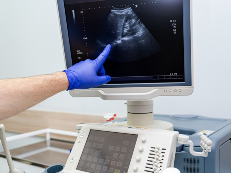 Tips for a Healthy Pregnancy